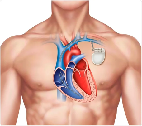 Best Cardiologist in Ahmedabad