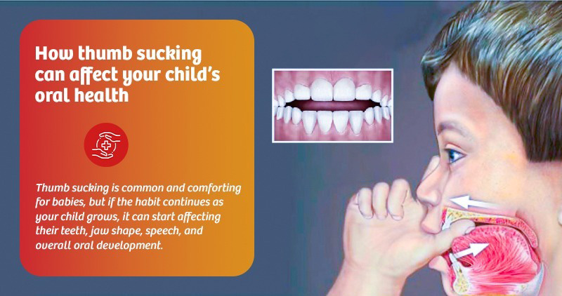 Thumb Sucking