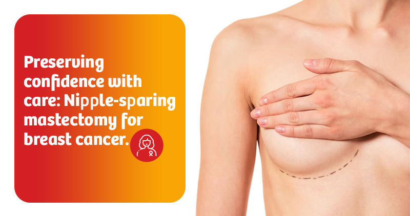 Breast Cancer 