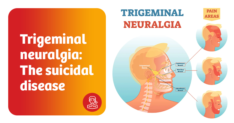 Trigeminal neuralgia