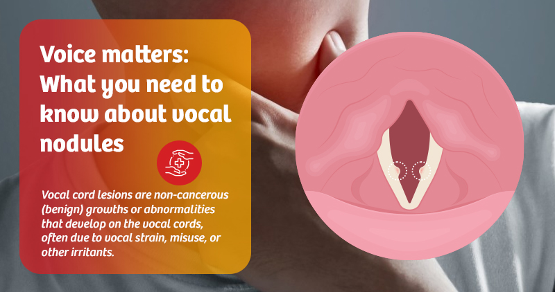 Voice matters What you need to know about vocal nodules